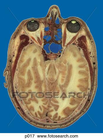 Stock Illustration - Head and Neck. Fotosearch