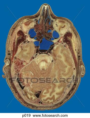 Head and Neck View Large Illustration Stock Illustration - Head and Neck. Fotosearch