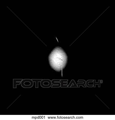Head - Transverse View Large Illustration Clip Art - Head - Transverse. Fotosearch