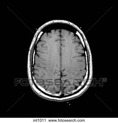 Head - Transverse View Large Illustration Clip Art - Head - Transverse. Fotosearch