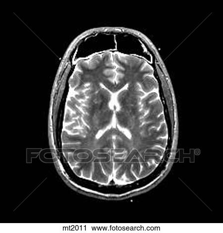 Clip Art - Head - Transverse. Fotosearch