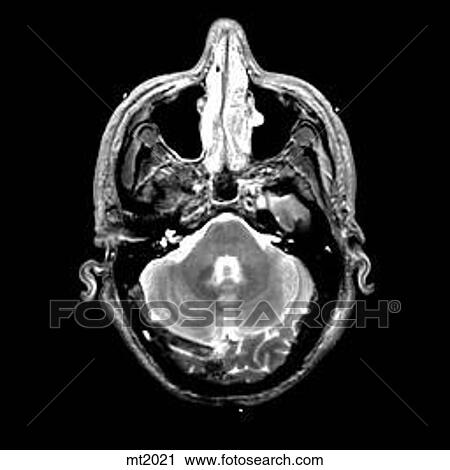 Clip Art - Head - Transverse. Fotosearch