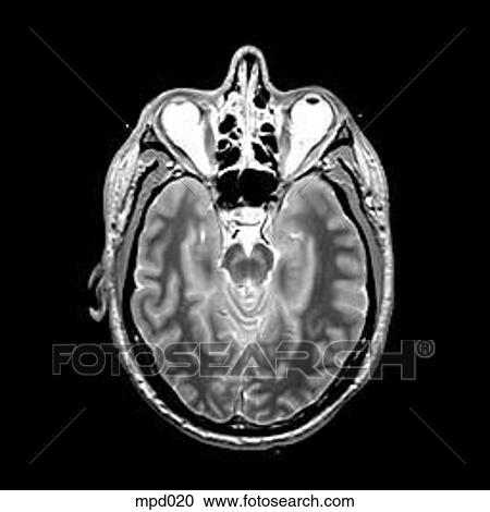 Head - Transverse View Large Illustration Clipart - Head - Transverse. Fotosearch