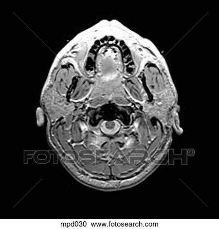 Head - Transverse View Large Illustration Clipart - Head - Transverse. Fotosearch