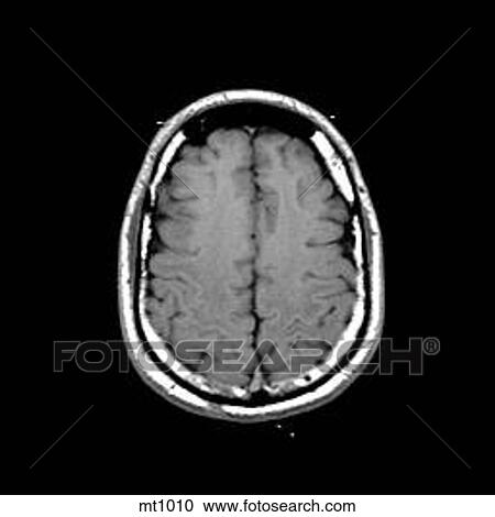 Head - Transverse View Large Illustration Clipart - Head - Transverse. Fotosearch