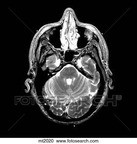 Head - Transverse View Large Illustration Clipart - Head - Transverse. Fotosearch
