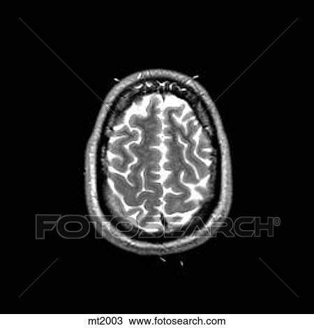 Head - Transverse View Large Illustration Drawing - Head - Transverse. Fotosearch