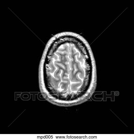 Stock Illustration - Head - Transverse. Fotosearch