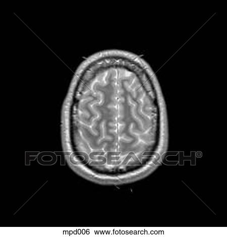 Head - Transverse View Large Illustration Stock Illustration - Head - Transverse. Fotosearch