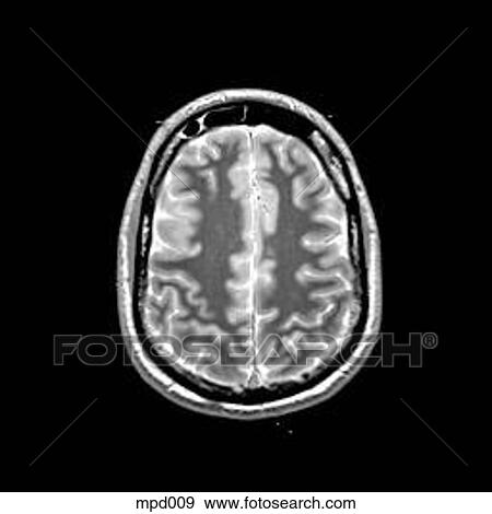 Head - Transverse View Large Illustration Stock Illustration - Head - Transverse. Fotosearch