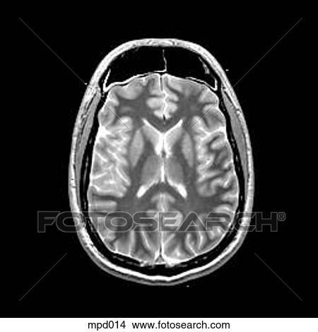 Head - Transverse View Large Illustration Stock Illustration - Head - Transverse. Fotosearch