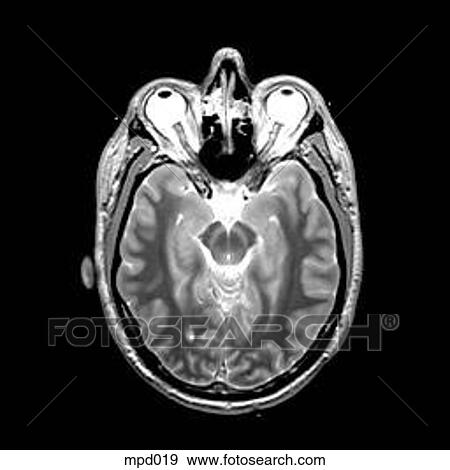 Head - Transverse View Large Illustration Stock Illustration - Head - Transverse. Fotosearch