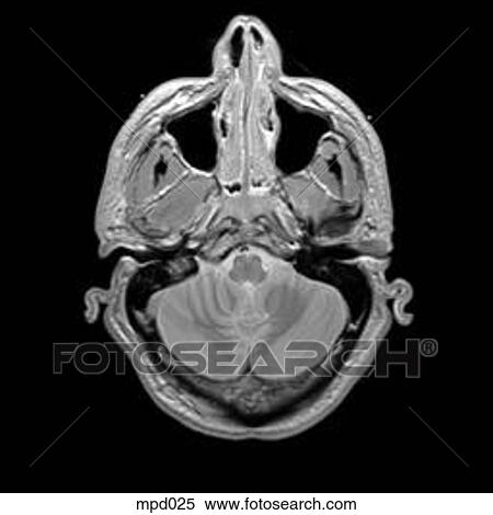 Head - Transverse View Large Illustration Stock Illustration - Head - Transverse. Fotosearch