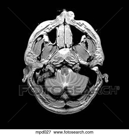 Head - Transverse View Large Illustration Stock Illustration - Head - Transverse. Fotosearch