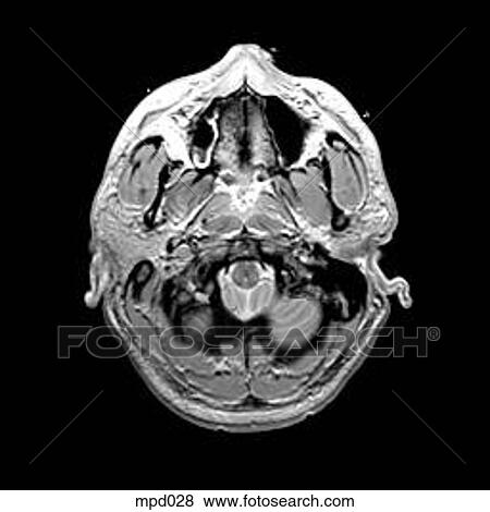 Head - Transverse View Large Illustration Stock Illustration - Head - Transverse. Fotosearch