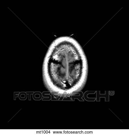Stock Illustration - Head - Transverse. Fotosearch