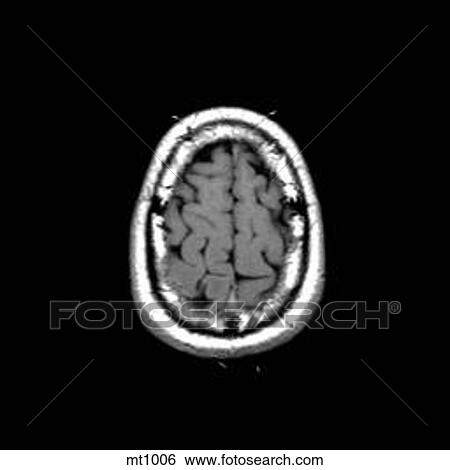 Head - Transverse View Large Illustration Stock Illustration - Head - Transverse. Fotosearch