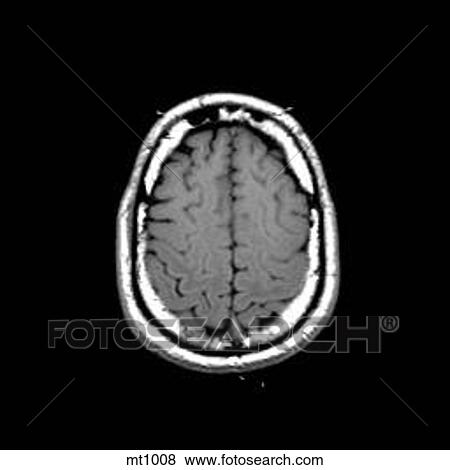Head - Transverse View Large Illustration Stock Illustration - Head - Transverse. Fotosearch