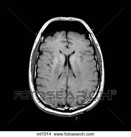 Head - Transverse View Large Illustration Stock Illustration - Head - Transverse. Fotosearch