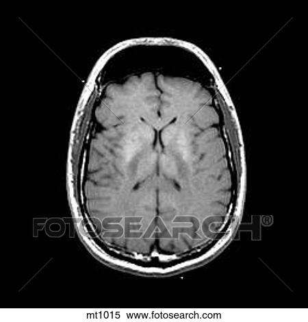 Head - Transverse View Large Illustration Stock Illustration - Head - Transverse. Fotosearch