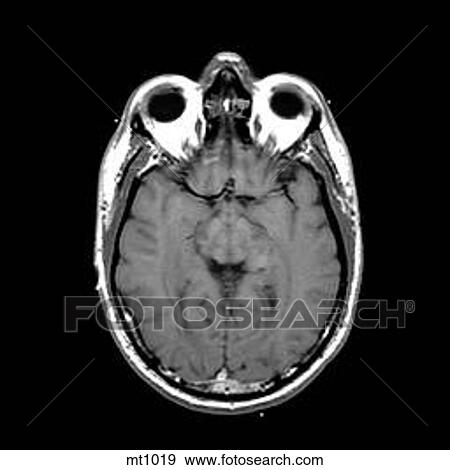 Head - Transverse View Large Illustration Stock Illustration - Head - Transverse. Fotosearch