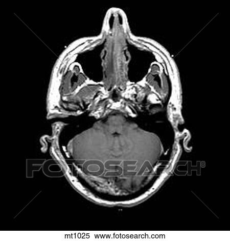 Head - Transverse View Large Illustration Stock Illustration - Head - Transverse. Fotosearch