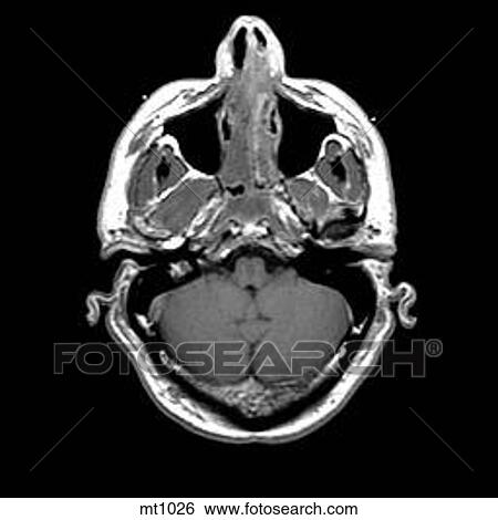 Head - Transverse View Large Illustration Stock Illustration - Head - Transverse. Fotosearch