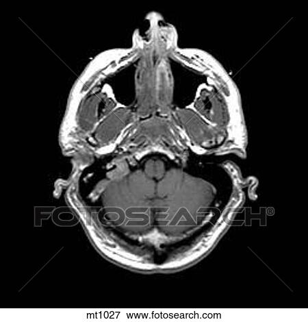 Head - Transverse View Large Illustration Stock Illustration - Head - Transverse. Fotosearch