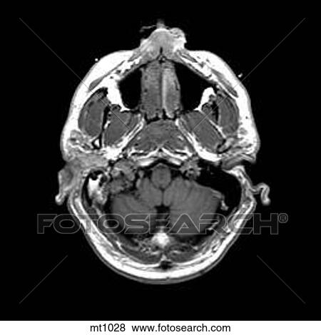 Head - Transverse View Large Illustration Stock Illustration - Head - Transverse. Fotosearch