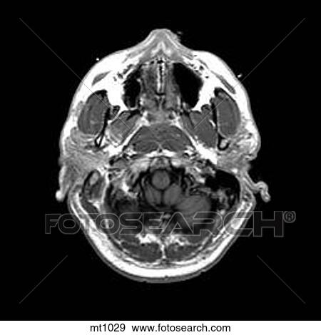 Head - Transverse View Large Illustration Stock Illustration - Head - Transverse. Fotosearch