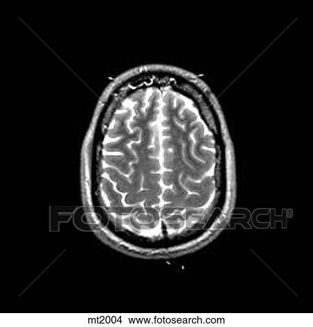 Head - Transverse View Large Illustration Stock Illustration - Head - Transverse. Fotosearch