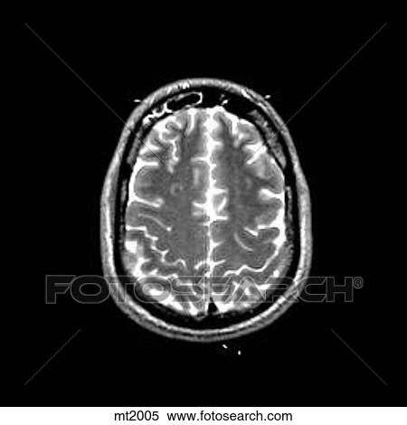 Head - Transverse View Large Illustration Stock Illustration - Head - Transverse. Fotosearch