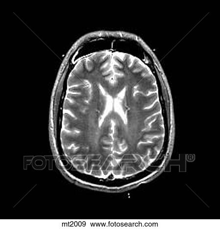 Head - Transverse View Large Illustration Stock Illustration - Head - Transverse. Fotosearch
