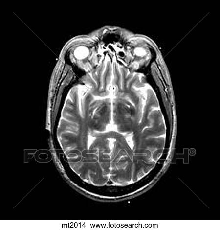 Head - Transverse View Large Illustration Stock Illustration - Head - Transverse. Fotosearch