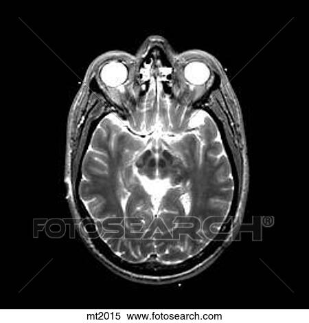 Head - Transverse View Large Illustration Stock Illustration - Head - Transverse. Fotosearch
