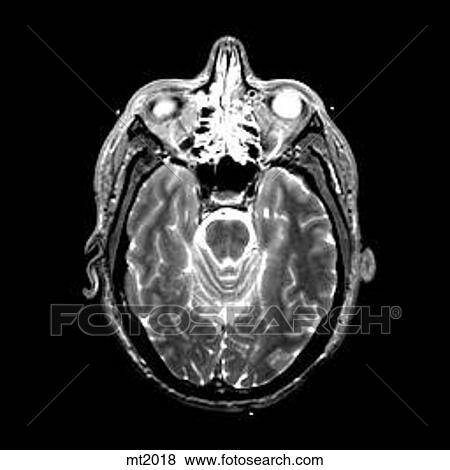 Head - Transverse View Large Illustration Stock Illustration - Head - Transverse. Fotosearch