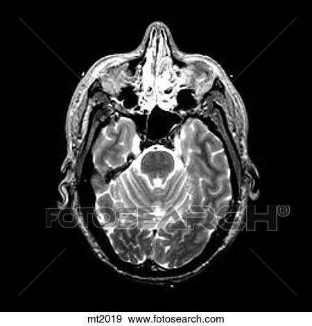 Head - Transverse View Large Illustration Stock Illustration - Head - Transverse. Fotosearch
