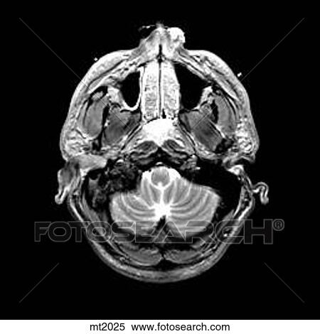 Head - Transverse View Large Illustration Stock Illustration - Head - Transverse. Fotosearch