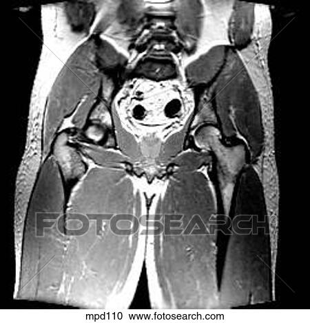 Hips/Legs - Coronal View Large Illustration Clipart - Hips/Legs - Coronal. Fotosearch