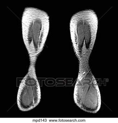 Knee - Coronal View Large Illustration Drawing - Knee - Coronal. Fotosearch