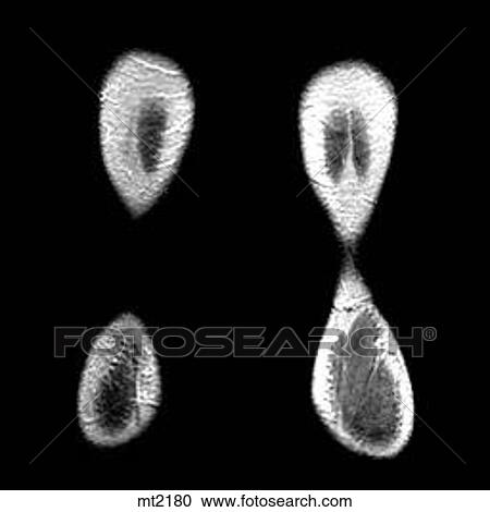 Legs - Coronal View Large Illustration Clipart - Legs - Coronal. Fotosearch