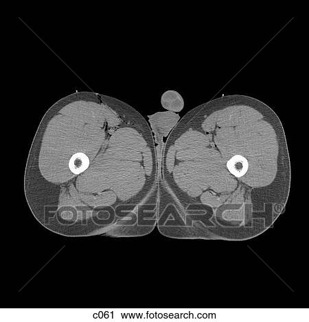 Clip Art - Legs - Feet. Fotosearch