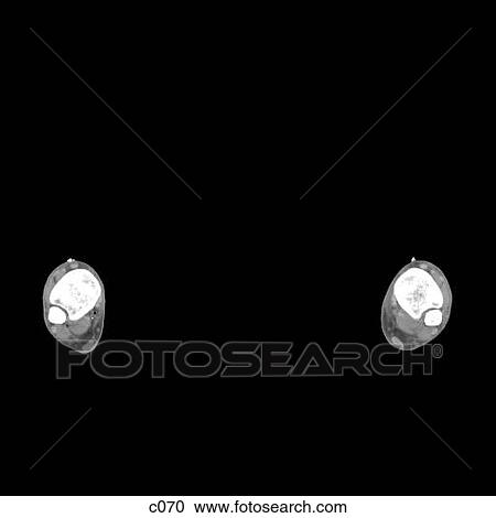 Clipart - Legs - Feet. Fotosearch