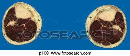 Clipart - Legs - Feet. Fotosearch