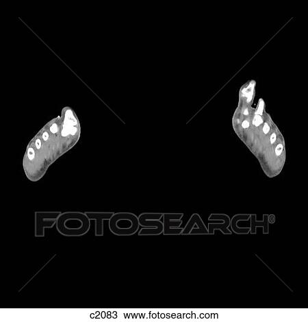 Legs - Feet View Large Illustration Drawing - Legs - Feet. Fotosearch