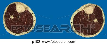 Drawing - Legs - Feet. Fotosearch
