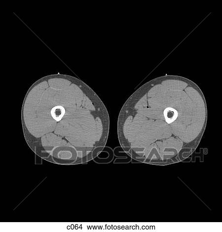 Stock Illustration - Legs - Feet. Fotosearch