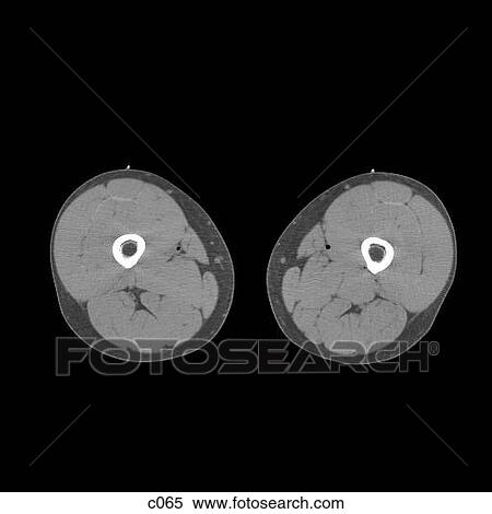 Legs - Feet View Large Illustration Stock Illustration - Legs - Feet. Fotosearch