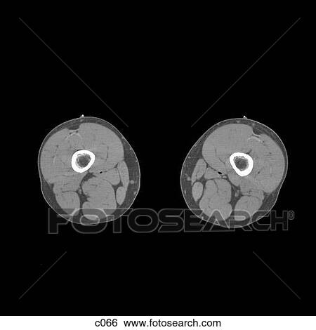 Stock Illustration - Legs - Feet. Fotosearch