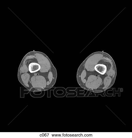 Stock Illustration - Legs - Feet. Fotosearch